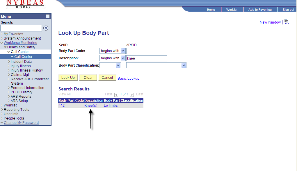 Call Center - Injury Detail - Body Part Description